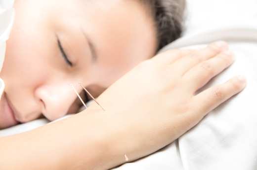 Five Health Concerns That Can Be Treated with Acupuncture