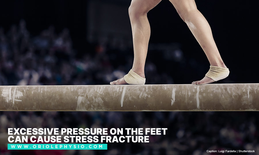 Excessive pressure on the feet can cause stress fracture