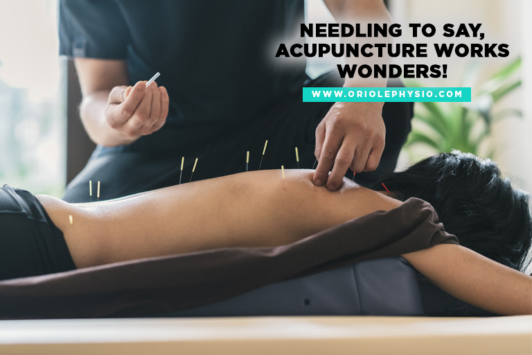 Needling to say, acupuncture works wonders!