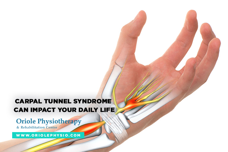 Carpal tunnel syndrome can impact your daily life